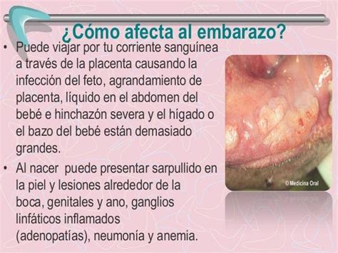 Virus Del Papiloma Y Embarazada Virus De Papiloma Humano Y El Embarazo