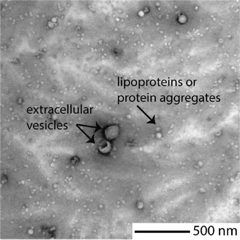 Transmission Electron Microscopy Image Of Extracellular Vesicles In