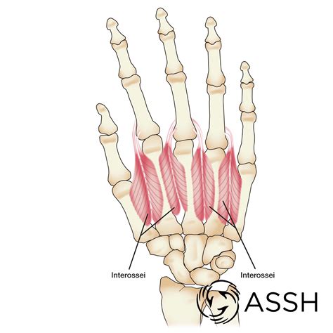 The aim of this paper was to review the anatomy the platysma systematically.the term platysma and anatomy was used to search pubmed and scopus, producing 394 and 214 papers, respectively. Body Anatomy: Upper Extremity Muscles | The Hand Society