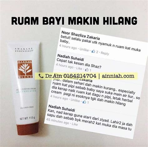 The virus that causes chicken pox is the same virus that causes shingles in adults. Krim Untuk Ruam Bayi Yang Anda Cari - Kedai Vitamin ...