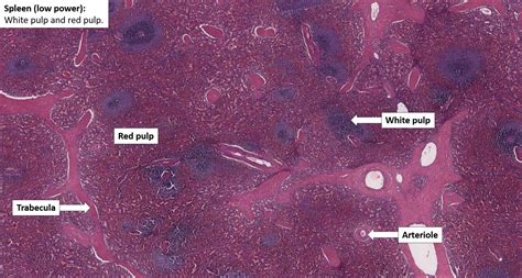 Spleen Normal Histology Nus Pathweb Nus Pathweb