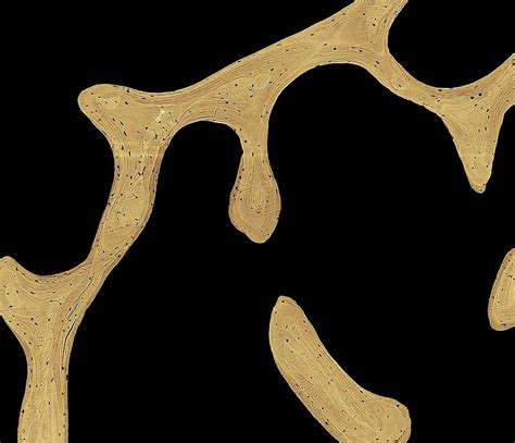 This is a short tutorial using blender 2.8 that shows how to create a bone cross section and using images to create the textures. Bone Cross-section Photograph by Science Photo Library