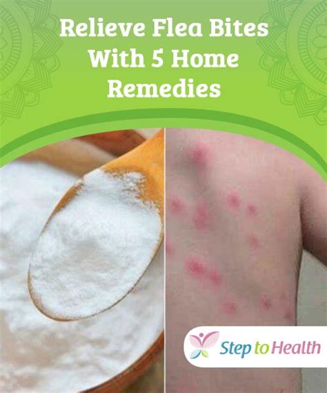 Relieve Flea Bites With 5 Home Remedies Fleas Bed Bug Bites