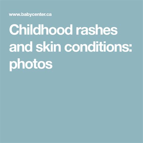 Childhood Rashes And Skin Conditions Photos Skin Conditions Skin
