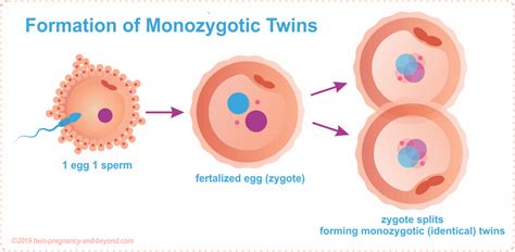What Is Twin Zygosity Understanding Different Types Of Twinning