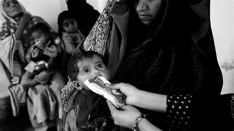 addressing malnutrition in pakistan the urgent need for collaborative action