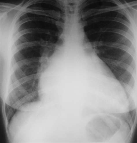 Nov 25, 2020 · a comprehensive database of more than 10 cardiology quizzes online, test your knowledge with cardiology quiz questions. Cardiology X-ray Quiz 19