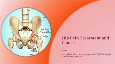 Hip Pain Treatment And Causes