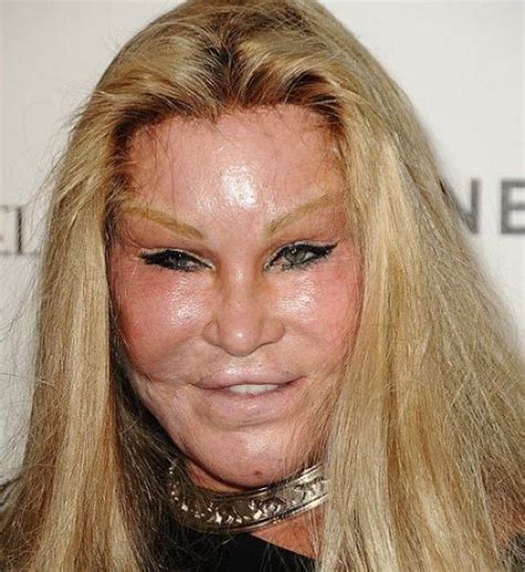30 horrifying results of terrible plastic surgery wtf gallery botched plastic surgery bad