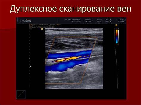 Диета лимфостазах нижних конечностей