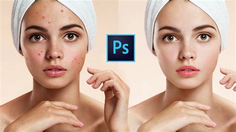 Photoshop Tutorial How To Remove Pimple Acne And Make Skin Smooth