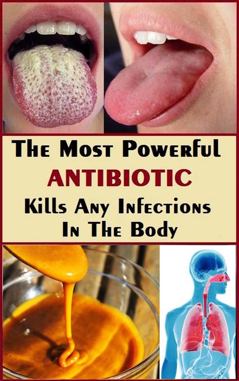 Make The Strongest Antibiotic With Only Natural Ingredients Healthy