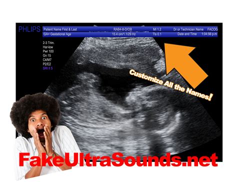 Free with in app purchases. Uber Funny April Fools Day Fake Ultrasound Prank ...