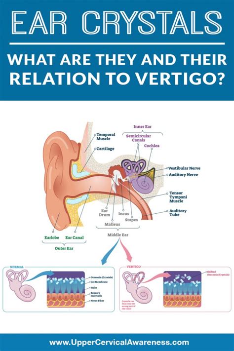Ear Crystals What Are They And Relations To Vertigo Upper Cervical