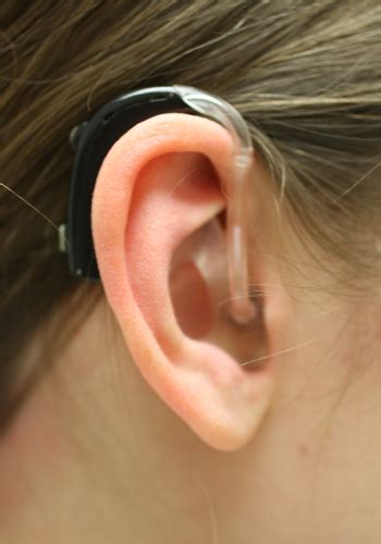 Best hearing aids in 2021. Behind-the-Ear (BTE) Hearing Aids Styles - Hearing Aids