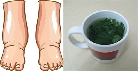 This Powerful Tea Cures Swollen Legs In Just A Few Days Women Daily