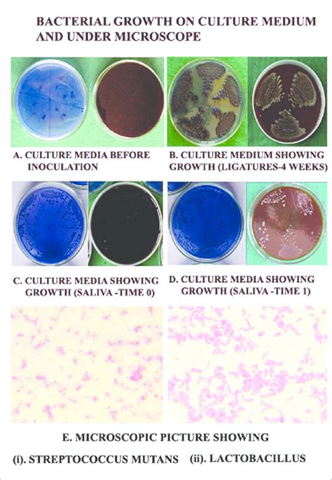 Culture Plates And Gram Staining Of The Colonies Download Scientific