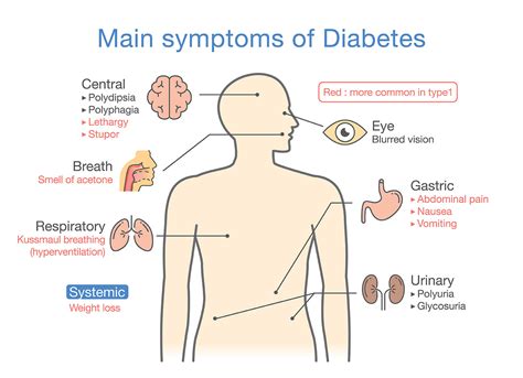 What Are The Most Telling Symptoms Of Type Diabetes And Why You Shouldnt Ignore Them