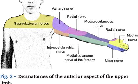 Figure 2 From Ultrasound And Nerve Stimulation‐guided Axillary Block