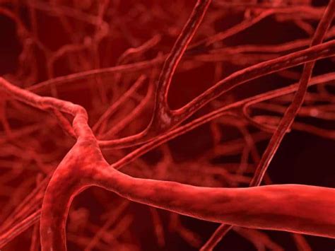 Malformación Arteriovenosa Qué Síntomas Tratamiento Y Más