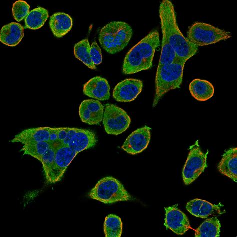 We have reconstructed this atlas. Proteine Atlas Rat : The Allen Brain Atlas Toward ...