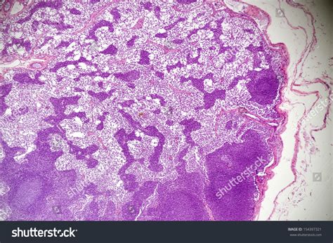 Microscopic View Lymph Node Stock Photo Royalty Free 154397321