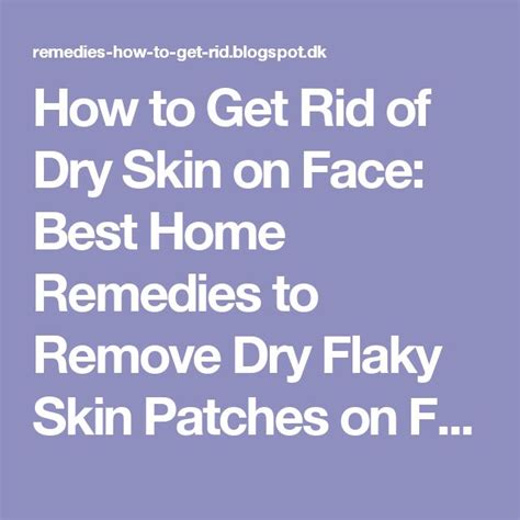 How To Get Rid Of Dry Skin On Face Best Home Remedies To Remove Dry