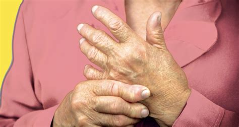 Hand Surgery Options For Rheumatoid Arthritis Patients The Medical