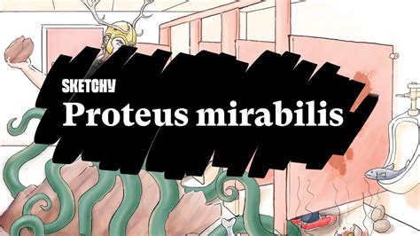 Proteus Mirabilis Lesson Motility Urease Positivity And Treatment