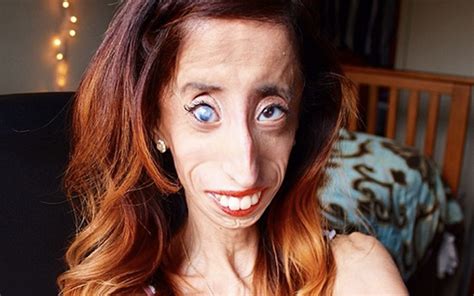 the world s ugliest woman and how she beat her bullies