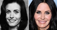 Courteney Cox's plastic surgery transformation | Now To Love