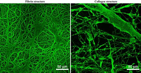 Frontiers Fibrin And Collagen Structures On Nanofibrous Membranes As