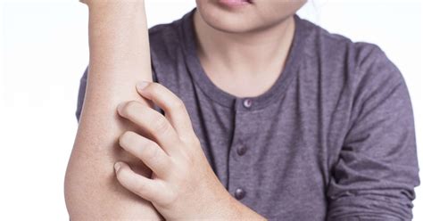 Formication: Definition, causes, and treatment