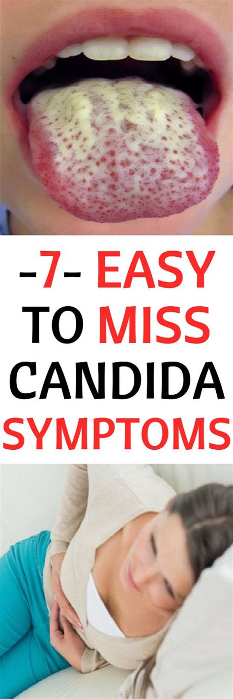 Check Out These Candida Symptoms That Are Easy To Miss Candida