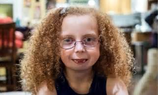 Seattle Girl Born With Auriculo Condylar Syndromes Jaw Grown Back By
