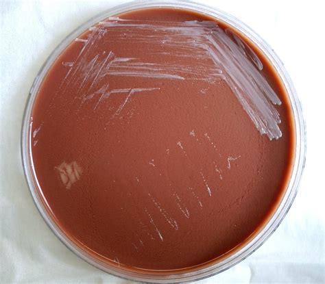 Free Picture Gram Negative Brucella Abortus Bacteria Grown