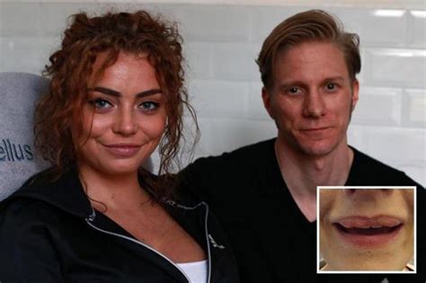 Newcastle Model Beth Cowan Scarred For Life With Distorted And Lumpy