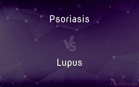 Psoriasis Vs Lupus — Whats The Difference