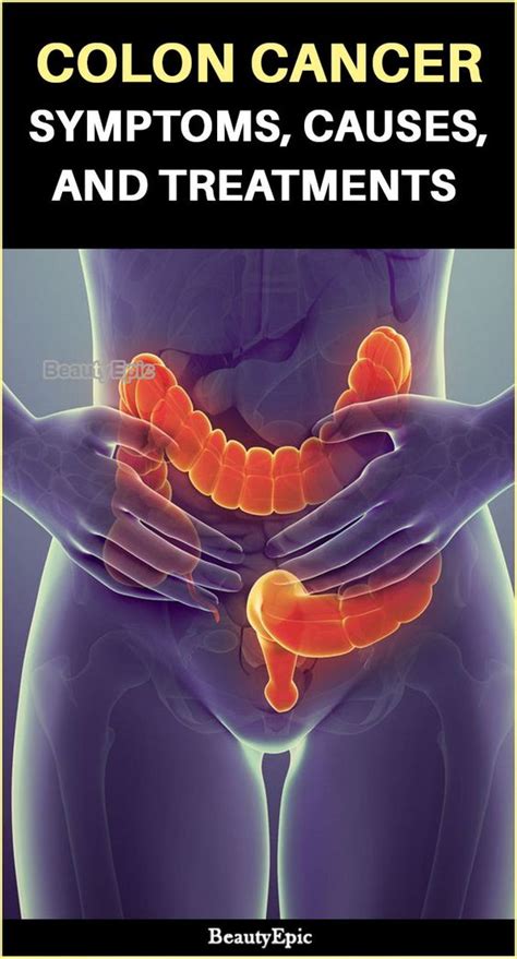 Here in this article, we are going to know the signs and symptoms of this colon cancer and how to overcome this problem with an early treatment to get faster recovery. Colon Cancer: Symptoms, Causes, And Treatments | Healthy ...