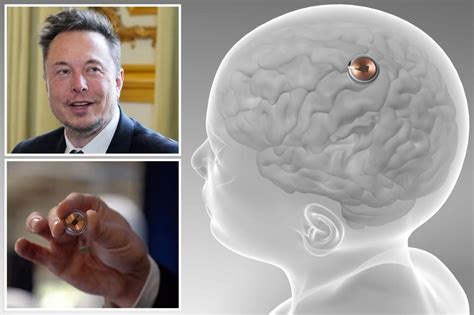 La Fda Approuve Les Implants Neuralink Delon Musk Pour Le Test Humain