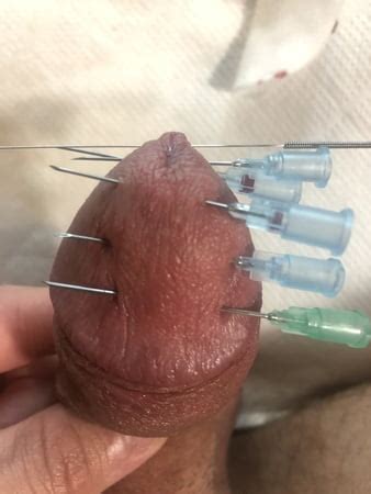 Needle Torture Cbt Pics Xhamster Sexiezpix Web Porn
