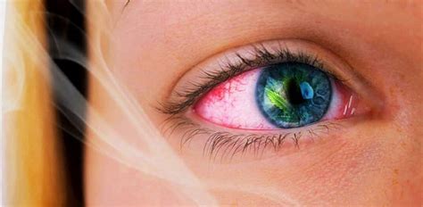 How To Get Rid Of Red Eyes After Smoking Weed The Cannabis Advisory