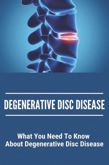 Understanding Degenerative Disc Disease Causes Symptoms And
