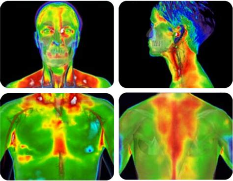 what is thermography choice thermography