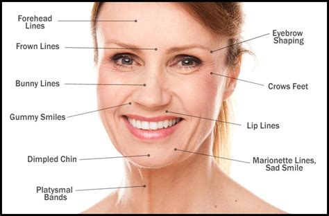 Botox is one of the most effective ways of reducing the appearance of crow's feet. Botox JUST Approved By The FDA For Crows Feet