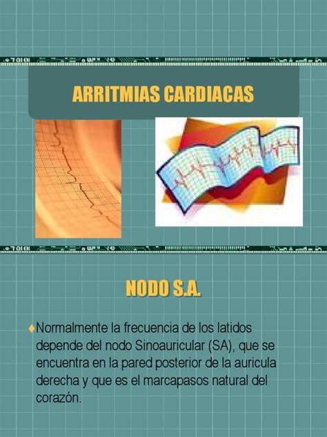 Arritmias Cardiacas Pdf Arritmia Cardiaca Fisiología Cardiovascular