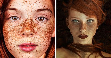 15 Personas Con Pecas Que Te Hipnotizarán Con Su Belleza única Bored Panda