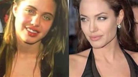 Angelina Jolie Plastic Surgery Pictures Youtube