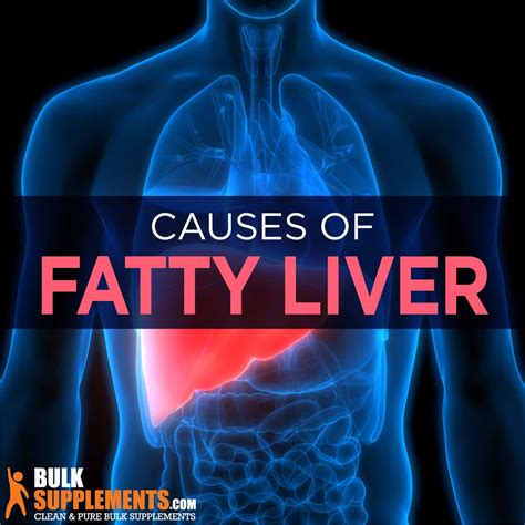 Fatty Liver Disease Symptoms Causes And Treatment By James Denlinger