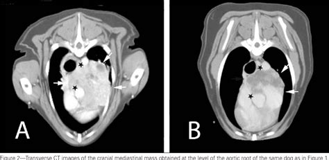 Figure 2 From Use Of Three Dimensional Conformal Radiation Therapy For